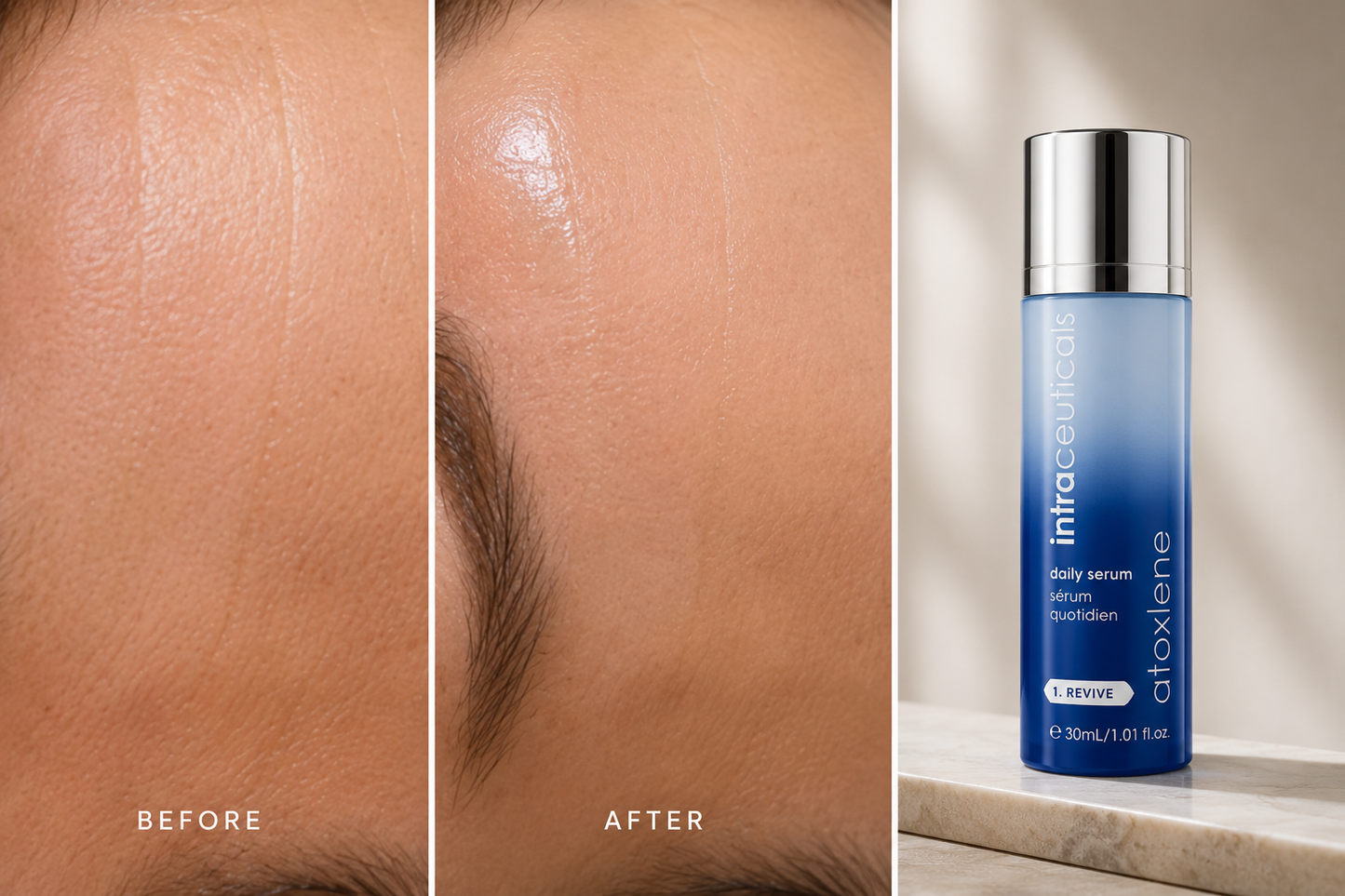 a side by side of human skin of and a bottle of the intraceuticals atoxelene daily serum 