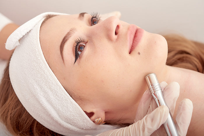 Microdermabrasion in Aspen